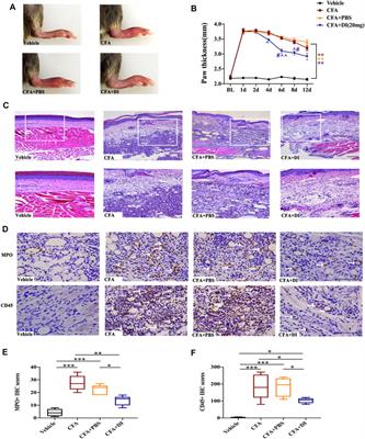 Dimethyl Itaconate Attenuates CFA-Induced Inflammatory Pain via the NLRP3/ IL-1β Signaling Pathway